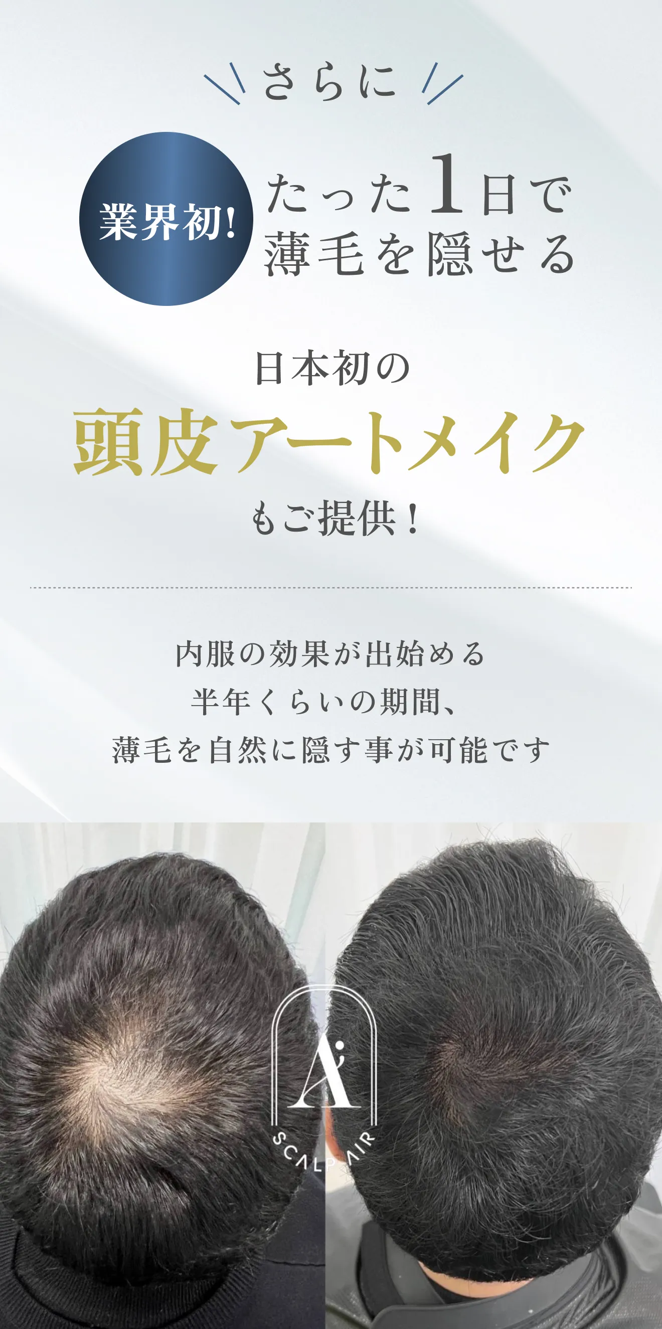 さらに業界初!たった1日で薄毛を隠せる日本初の頭皮アートメイクもご提供可能!内服の効果が出始める半年くらいの期間、薄毛を自然に隠す事が可能です。